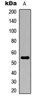 Western blot analysis of ALDH1A2 expression in MCF7 (A) whole cell lysates.