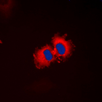 Immunofluorescent analysis of ALDH1A2 staining in HepG2 cells. Formalin-fixed cells were permeabilized with 0.1% Triton X-100 in TBS for 5-10 minutes and blocked with 3% BSA-PBS for 30 minutes at room temperature. Cells were probed with the primary antibody in 3% BSA-PBS and incubated overnight at 4 ��C in a hidified chamber. Cells were washed with PBST and incubated with a DyLight 594-conjugated secondary antibody (red) in PBS at room temperature in the dark. DAPI was used to stain the cell nuclei (blue).