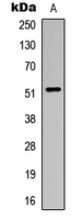 Western blot analysis of ALDH3B1 expression in HuvEc (A) whole cell lysates.