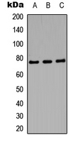 Western blot analysis of Amphiphysin 1 expression in SHSYS5 (A); mouse brain (B); PC12 (C) whole cell lysates.