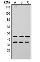 Western blot analysis of Apolipoprotein L3 expression in A549 (A); PC12 (B); NS-1 (C) whole cell lysates.