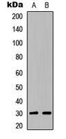 Western blot analysis of ATF5 expression in Jurkat (A); NIH3T3 (B) whole cell lysates.