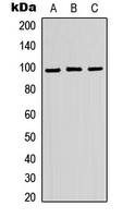 Western blot analysis of ATP6V0A2 expression in HEK293T (A); Raw264.7 (B); H9C2 (C) whole cell lysates.