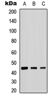 Western blot analysis of B4GALT2 expression in A549 (A); NS-1 (B); PC12 (C) whole cell lysates.