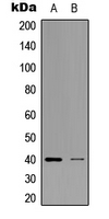 Western blot analysis of ZNF134 expression in K562 (A); HEK293T (B) whole cell lysates.