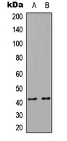Western blot analysis of CCR4 expression in HEK293T (A); NIH3T3 (B) whole cell lysates.