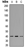 Western blot analysis of CCR11 expression in HeLa (A); SW480 (B); HepG2 (C) whole cell lysates.