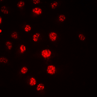 Immunofluorescent analysis of CDC16 staining in HeLa cells. Formalin-fixed cells were permeabilized with 0.1% Triton X-100 in TBS for 5-10 minutes and blocked with 3% BSA-PBS for 30 minutes at room temperature. Cells were probed with the primary antibody in 3% BSA-PBS and incubated overnight at 4 ��C in a hidified chamber. Cells were washed with PBST and incubated with a DyLight 594-conjugated secondary antibody (red) in PBS at room temperature in the dark. DAPI was used to stain the cell nuclei (blue).