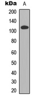Western blot analysis of CDCA2 expression in HEK293T (A) whole cell lysates.