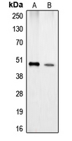 Western blot analysis of Carboxypeptidase A1 expression in Jurkat (A); HeLa (B) whole cell lysates.