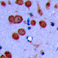 Immunohistochemical analysis of Cadherin 19 staining in human brain formalin fixed paraffin embedded tissue section. The section was pre-treated using heat mediated antigen retrieval with sodium citrate buffer (pH 6.0). The section was then incubated with the antibody at room temperature and detected using an HRP conjugad compact polymer system. DAB was used as the chromogen. The section was then counterstained with haematoxylin and mounted with DPX. w
