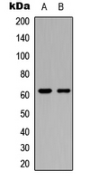 Western blot analysis of CERKL expression in MCF7 (A); COLO205 (B) whole cell lysates.
