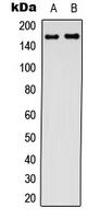 Western blot analysis of CFTR expression in SHSY5Y (A); NIH3T3 (B) whole cell lysates.