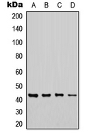 Western blot analysis of CHST6 expression in MCF7 (A); Jurkat (B); NS-1 (C); H9C2 (D) whole cell lysates.
