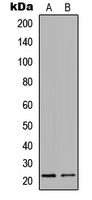 Western blot analysis of Claudin 3 expression in SW480 (A); LOVO (B) whole cell lysates.