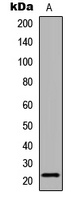 Western blot analysis of Claudin 6 expression in COLO205 (A) whole cell lysates.