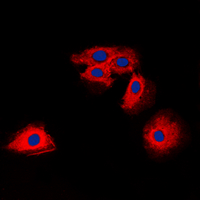 Immunofluorescent analysis of Claudin 6 staining in HuvEc cells. Formalin-fixed cells were permeabilized with 0.1% Triton X-100 in TBS for 5-10 minutes and blocked with 3% BSA-PBS for 30 minutes at room temperature. Cells were probed with the primary antibody in 3% BSA-PBS and incubated overnight at 4 ��C in a hidified chamber. Cells were washed with PBST and incubated with a DyLight 594-conjugated secondary antibody (red) in PBS at room temperature in the dark. DAPI was used to stain the cell nuclei (blue).
