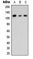 Western blot analysis of CNK2 expression in HEK293T (A); mouse Brain (B); rat brain (C) whole cell lysates.