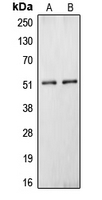 Western blot analysis of Carboxypeptidase N 1 expression in HepG2 (A); HEK293T (B) whole cell lysates.