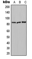 Western blot analysis of Carboxypeptidase N 2 expression in MCF7 (A); HeLa (B); Raw264.7 (C) whole cell lysates.