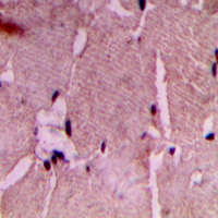 Immunohistochemical analysis of COX7A2/3 staining in human heart formalin fixed paraffin embedded tissue section. The section was pre-treated using heat mediated antigen retrieval with sodium citrate buffer (pH 6.0). The section was then incubated with the antibody at room temperature and detected using an HRP conjugad compact polymer system. DAB was used as the chromogen. The section was then counterstained with haematoxylin and mounted with DPX.