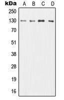 Western blot analysis of CD131 expression in HL60 (A); TF1 (B); SP2/0 (C); H9C2 (D) whole cell lysates.