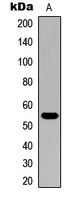Western blot analysis of Cytochrome P450 21A2 expression in HeLa (A) whole cell lysates.