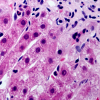 Immunohistochemical analysis of Cytochrome P450 21A2 staining in human liver formalin fixed paraffin embedded tissue section. The section was pre-treated using heat mediated antigen retrieval with sodium citrate buffer (pH 6.0). The section was then incubated with the antibody at room temperature and detected using an HRP conjugad compact polymer system. DAB was used as the chromogen. The section was then counterstained with haematoxylin and mounted with DPX.
