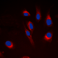 Immunofluorescent analysis of Cytochrome P450 21A2 staining in Hela cells. Formalin-fixed cells were permeabilized with 0.1% Triton X-100 in TBS for 5-10 minutes and blocked with 3% BSA-PBS for 30 minutes at room temperature. Cells were probed with the primary antibody in 3% BSA-PBS and incubated overnight at 4 deg C in a hidified chamber. Cells were washed with PBST and incubated with a DyLight 594-conjugated secondary antibody (red) in PBS at room temperature in the dark. DAPI was used to stain the cell nuclei (blue).