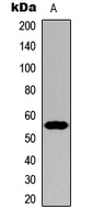 Western blot analysis of Cytochrome P450 21A2 expression in HeLa (A) whole cell lysates.