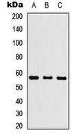 Western blot analysis of Cytochrome P450 26C1 expression in HEK293T (A); Raw264.7 (B); H9C2 (C) whole cell lysates.