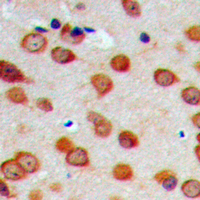Immunohistochemical analysis of Cytochrome P450 26C1 staining in human brain formalin fixed paraffin embedded tissue section. The section was pre-treated using heat mediated antigen retrieval with sodium citrate buffer (pH 6.0). The section was then incubated with the antibody at room temperature and detected using an HRP conjugad compact polymer system. DAB was used as the chromogen. The section was then counterstained with haematoxylin and mounted with DPX.