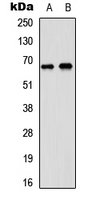 Western blot analysis of DDX5 expression in A431 (A); SHSY5Y (B) whole cell lysates.
