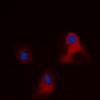 Immunofluorescent analysis of EIF3L staining in HEK293 cells. Formalin-fixed cells were permeabilized with 0.1% Triton X-100 in TBS for 5-10 minutes and blocked with 3% BSA-PBS for 30 minutes at room temperature. Cells were probed with the primary antibody in 3% BSA-PBS and incubated overnight at 4 deg C in a hidified chamber. Cells were washed with PBST and incubated with a DyLight 594-conjugated secondary antibody (red) in PBS at room temperature in the dark. DAPI was used to stain the cell nuclei (blue).