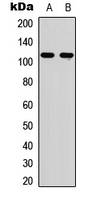 Western blot analysis of EPHA6 expression in A549 (A); NS-1 (B) whole cell lysates.