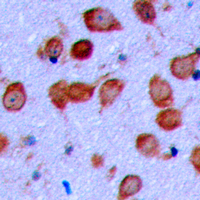 Immunohistochemical analysis of EPHA6 staining in human brain formalin fixed paraffin embedded tissue section. The section was pre-treated using heat mediated antigen retrieval with sodium citrate buffer (pH 6.0). The section was then incubated with the antibody at room temperature and detected using an HRP conjugad compact polymer system. DAB was used as the chromogen. The section was then counterstained with haematoxylin and mounted with DPX.