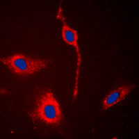 Immunofluorescent analysis of EPHA6 staining in A549 cells. Formalin-fixed cells were permeabilized with 0.1% Triton X-100 in TBS for 5-10 minutes and blocked with 3% BSA-PBS for 30 minutes at room temperature. Cells were probed with the primary antibody in 3% BSA-PBS and incubated overnight at 4 deg C in a hidified chamber. Cells were washed with PBST and incubated with a DyLight 594-conjugated secondary antibody (red) in PBS at room temperature in the dark. DAPI was used to stain the cell nuclei (blue).