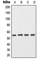 Western blot analysis of CK1 gamma 3 expression in HeLa (A); mouse testis (B); rat testis (C); PC12 (D) whole cell lysates.