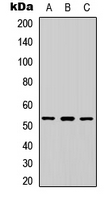 Western blot analysis of ETV4 expression in HeLa (A); Raw264.7 (B); PC12 (C) whole cell lysates.