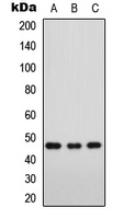 Western blot analysis of FOXD3 expression in Jurkat (A); K562 (B); NIH3T3 (C) whole cell lysates.