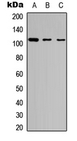 Western blot analysis of GAB1 (pY627) expression in Jurkat (A); K562 (B); NIH3T3 (C) whole cell lysates.