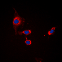 Immunofluorescent analysis of GABRB1 (pS434) staining in MCF7 cells. Formalin-fixed cells were permeabilized with 0.1% Triton X-100 in TBS for 5-10 minutes and blocked with 3% BSA-PBS for 30 minutes at room temperature. Cells were probed with the primary antibody in 3% BSA-PBS and incubated overnight at 4 deg C in a hidified chamber. Cells were washed with PBST and incubated with a DyLight 594-conjugated secondary antibody (red) in PBS at room temperature in the dark. DAPI was used to stain the cell nuclei (blue).