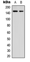 Western blot analysis of GAK expression in HeLa (A); Jurkat (B) whole cell lysates.