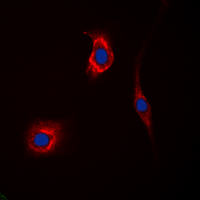 Immunofluorescent analysis of GAK staining in Hela cells. Formalin-fixed cells were permeabilized with 0.1% Triton X-100 in TBS for 5-10 minutes and blocked with 3% BSA-PBS for 30 minutes at room temperature. Cells were probed with the primary antibody in 3% BSA-PBS and incubated overnight at 4 deg C in a hidified chamber. Cells were washed with PBST and incubated with a DyLight 594-conjugated secondary antibody (red) in PBS at room temperature in the dark. DAPI was used to stain the cell nuclei (blue).