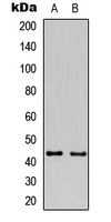 Western blot analysis of GAP43 expression in HeLa (A); mouse brain (B) whole cell lysates.