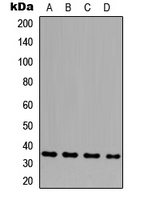 Western blot analysis of GLB1L3 expression in HeLa (A); THP1 (B); NS-1 (C); H9C2 (D) whole cell lysates.