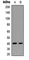 Western blot analysis of GNAT1 expression in U87MG (A); mouse brain (B) whole cell lysates.