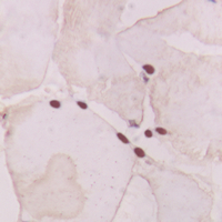 Immunohistochemical analysis of GNAT1 staining in human heart formalin fixed paraffin embedded tissue section. The section was pre-treated using heat mediated antigen retrieval with sodium citrate buffer (pH 6.0). The section was then incubated with the antibody at room temperature and detected using an HRP conjugad compact polymer system. DAB was used as the chromogen. The section was then counterstained with haematoxylin and mounted with DPX.