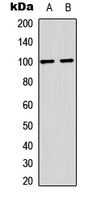 Western blot analysis of GLUR2 (pS880) expression in mouse brain (A); rat brain (B) whole cell lysates.
