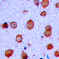 Immunohistochemical analysis of GLUR2 (pS880) staining in human brain formalin fixed paraffin embedded tissue section. The section was pre-treated using heat mediated antigen retrieval with sodium citrate buffer (pH 6.0). The section was then incubated with the antibody at room temperature and detected using an HRP conjugad compact polymer system. DAB was used as the chromogen. The section was then counterstained with haematoxylin and mounted with DPX.